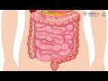 Stomach Diseases | VishwaRaj Hospital - Best Multispecialty Hospital in Pune