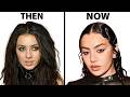 Charli XCX's NEW FACE | Plastic Surgery Analysis