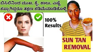 ಬಿಸಿಲಿನಿಂದ ಮುಖ, ಬಾಡಿ ಕಪ್ಪಾಗಿದರೆ ಮನೆ ಮದ್ದು| sun tan removal from face, hands, neck,leg|