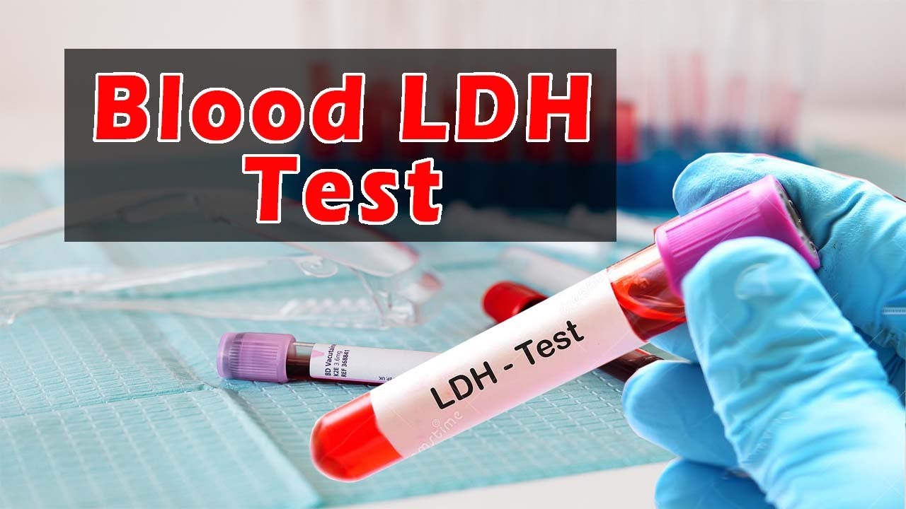 Blood LDH Test || LDH Test Procedure || LD Test || Lactate ...