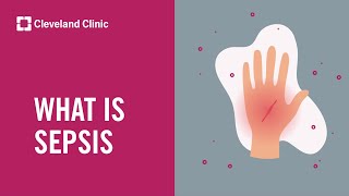 What Is Sepsis?