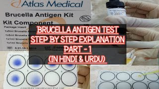 Brucella Antigen test Procedure \u0026 Practical explained step by step.Brucellosis.Brucella A \u0026 M Specie