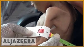 🇾🇪 'I could count the ribs on her chest': Yemeni refugees starving | Al Jazeera English