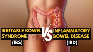 Difference between IBS (Irritable bowel Syndrome) and IBD (Inflammatory bowel disease)