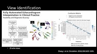 20. AI and ML for automation of chamber quantification - Dr. Wendy Tsang