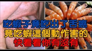 吃蝦子竟然吃出了「舌癌」，只因為在吃蝦時有這種「習慣動作」！快看看你有沒有啊