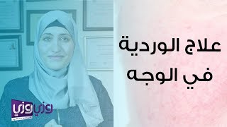 علاج الوردية في الوجه