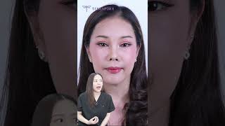 Facial Contour ศัลยกรรมสวยแบบธรรมชาติ ปรับรูปทรงใบหน้าให้สวยมีเสน่ห์และโหงวเฮ้งดีขึ้น ที่ธีรพร