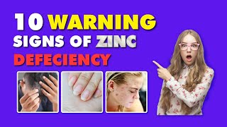 10 Symptoms Of Zinc Deficiency | Zinc Deficiency Signs | Vitamin Delight