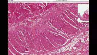 Anatomy | Histology of the Colon [Large Intestine]