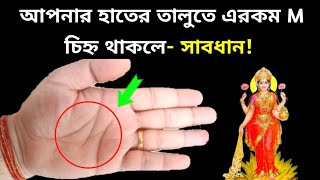 আপনার হাতেও কি M চিহ্ন আছে? / M sing in hand / সুবিচার