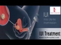 IUI Treatment In Coimbatore | Infertility Treatment In Tamil Nadu | IUI Procedure in India