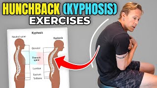 How to Improve Your Mid-Back Posture (Thoracic Kyphosis Exercises)