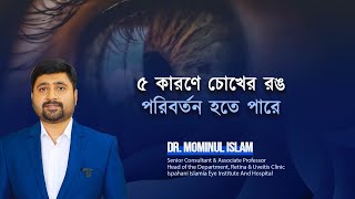 চোখের রঙ দেখে রোগ চেনার উপায় ।। Dr. Md Mominul Islam