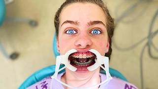 SOCKIE GOT BRACES \u0026 NOW SHE FEELS...