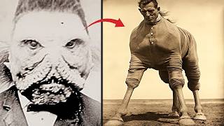 🔴▶ 44 BANNED Circus FREAKS That Actually Existed! Historical Photos, Rare Photos