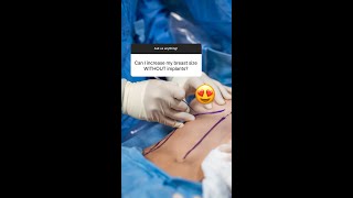 Can I Increase My Breast Size WITHOUT Implants? (YES!)