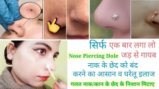 नाक के छेद को बंद करने का घरेलू  इलाज How To Close Nose /Ear Hole गलत Piercing का निशान कैसे मिटाए l