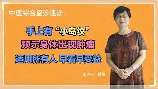 中医养生 手上出现“小岛纹”预示身体出现肿瘤，适用所有人，早看早受益！