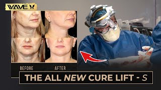 The New and Improved Cure Lift - S | Wave Plastic Surgery