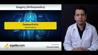 Osteoarthritis - General Aspects of Osteoarthritis