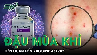 Thực Hư Việc Đậu Mùa Khỉ Là "Tác Dụng Phụ" Của Vaccine AstraZeneca? | SKĐS
