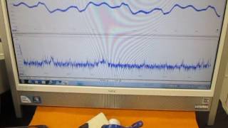 超音波を利用した「振動計測技術」