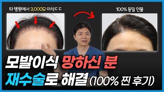 돈아낀다고 모발이식 싼 곳에서 하면 안되는 이유, 1만 번 이상 모발이식술한 의사가 알려드립니다.