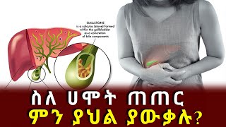 ስለ ሀሞት ጠጠር ምን ያህል ያውቃሉ? || EthioFM