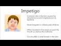 Impetigo   Child