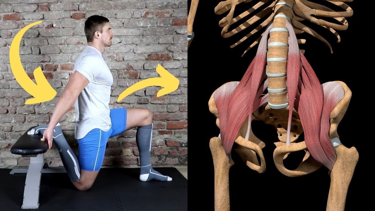 How To FIX Hyperlordosis - Anterior Pelvic Tilt (in 5 Minutes A Day ...