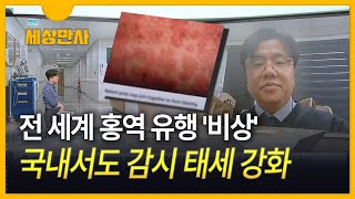 [세상만사] 전 세계 유행 '홍역' 국내 유입…설 연휴 확산 우려는