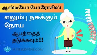 ஆஸ்டியோபோரோசிஸ் பற்றிய அதிர்ச்சியூட்டும் உண்மை - உங்களுக்கு வரக்கூடிய எலும்பு முறிவு நோய் !!!