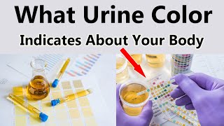 What Urine Color Indicates About Your Body #urinecolor #urinarytracthealth