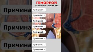 Как избежать ГЕМОРРОЯ? #меднавигатор #геморрой #проктолог