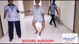Witness the Power of Shalby’s "Zero Technique”  Total Knee Replacement Surgery
