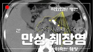 51번째 이야기, \