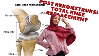 POST REKONSTRUKSI TOTAL KNEE REPLACEMENT 1-2 Minggu