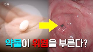 매일 먹는 약, 위를 해친다? | 위염 | 위궤양 | 명의 | #EBS건강