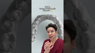 จัดฟันใสได้เปรียบกว่าจัดฟันแบบอื่น“ติ๊สสสนึง” #ทำฟันกับหมอกิฟ #dentist #หมอฟัน #invisalign #veneers