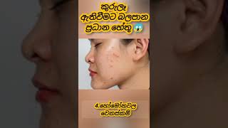 කුරුලෑ ඇති වෙන්න බලපාන 😞ප්‍රධාන හේතු 😱 Pimples \u0026 Skin whitening|How I got rid of acne#shorts#short