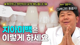 치아미백은 이렇게 하세요! 미백 고민 종결시켜 드립니다 feat.누런이탈출