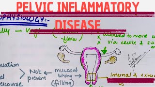 PELVIC INFLAMMATORY DISEASE | MEDICINE with DR SHAMAMA.