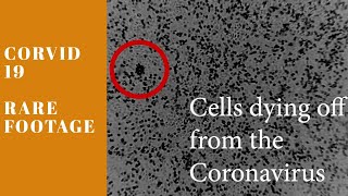 Coronavirus (Rare Footage) Corvid-19: Microscopic Observation