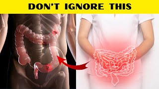 Top 10 Early Warning Signs of Colon Cancer | Don't Ignore!