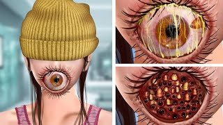 ASMR Remove the Parasitic Giant Eye & Maggots on the mouth | Deep Cleaning Animation