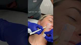 Tighten skin non-surgically and boost collagen production with Ultherapy at Wise Med Spa (Wayne, NJ)