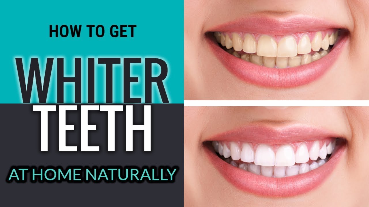 How To Get Whiter Teeth At Home | How To Make Teeth Whiter -- HOW TO's ...