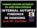 44. INTERNAL AUTOPSY FINDINGS IN HANGING-BY DR JAVED IQBAL KHOKHAR