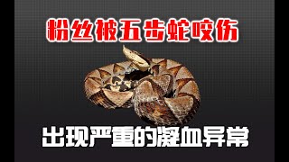 粉丝被五步蛇咬了！没有烂肉却出现了凝血异常？